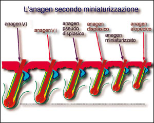 Calvizie Fase 2